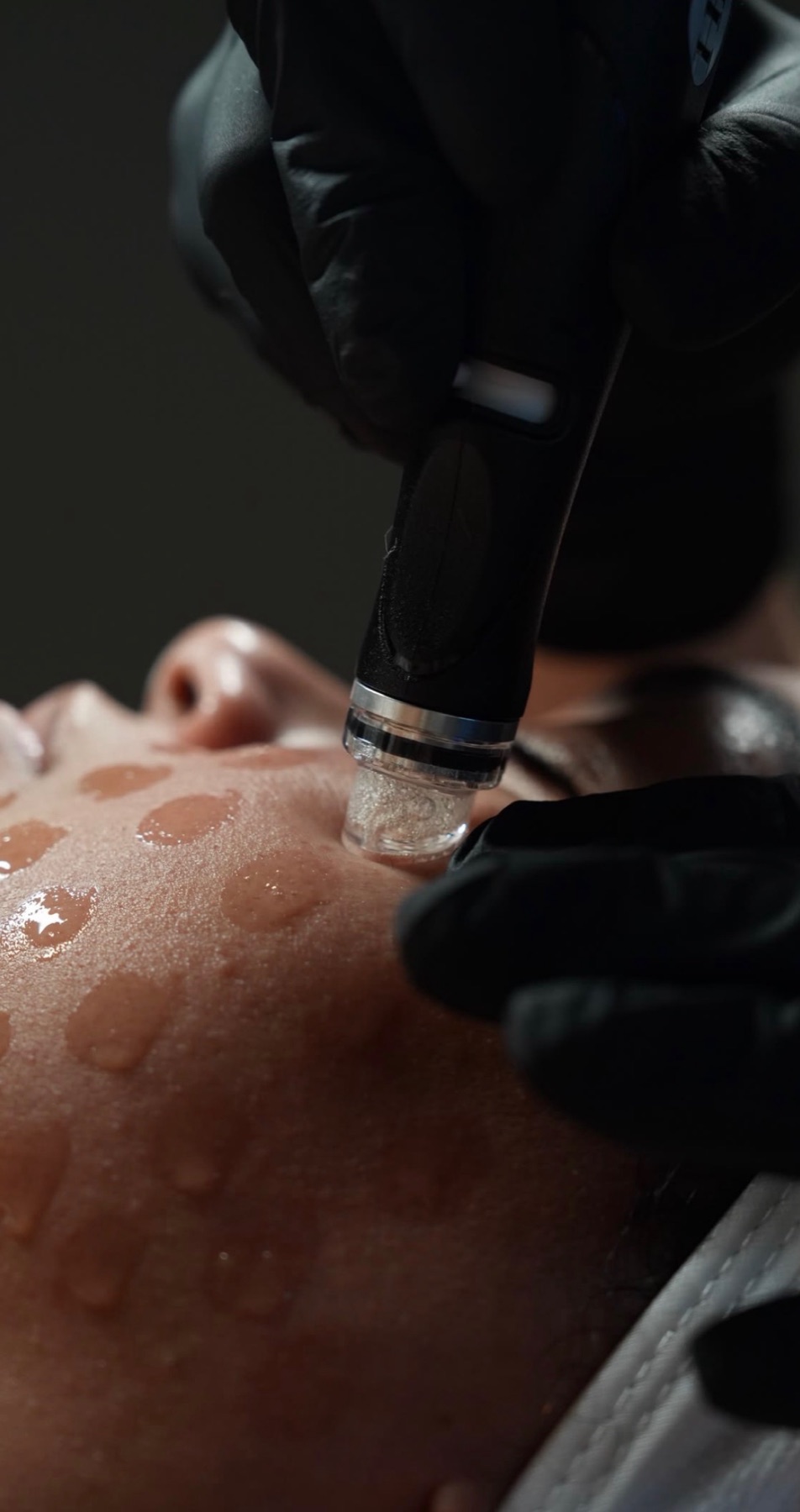 HydraFacial treatment at Integrated Spa